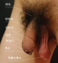 男性外生殖器